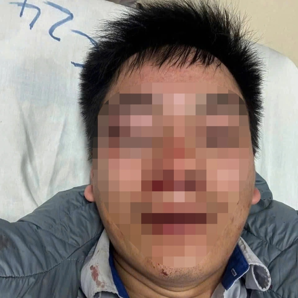 Tài xế buýt ở Hà Nội bị hành hung ngay trên xe - 2 Tài xế buýt ở Hà Nội bị hành hung ngay trên xe - 2