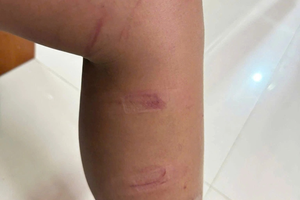 Xác định được người đàn ông đẩy ngã xe, đánh 3 cháu bé ở Quảng Ngãi - 1