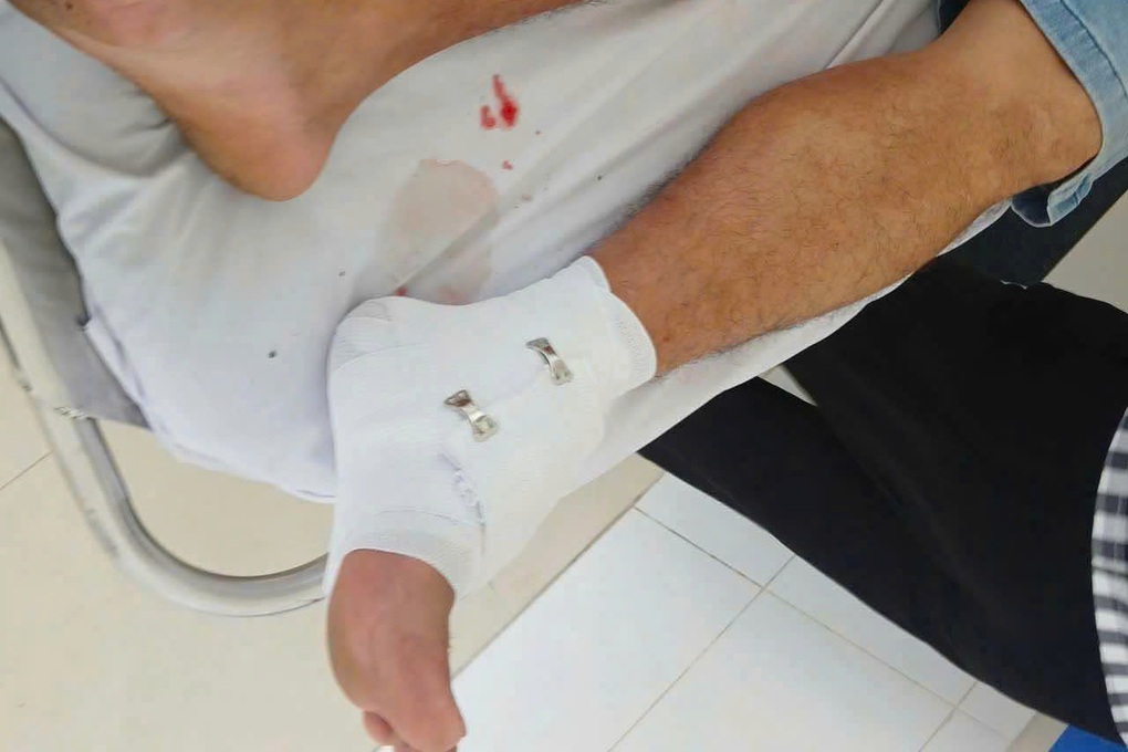 Cá sấu sổng chuồng cắn người ở Tây Ninh, chủ nuôi bị phạt 315 triệu đồng - 2 Cá sấu sổng chuồng cắn người ở Tây Ninh, chủ nuôi bị phạt 315 triệu đồng - 2