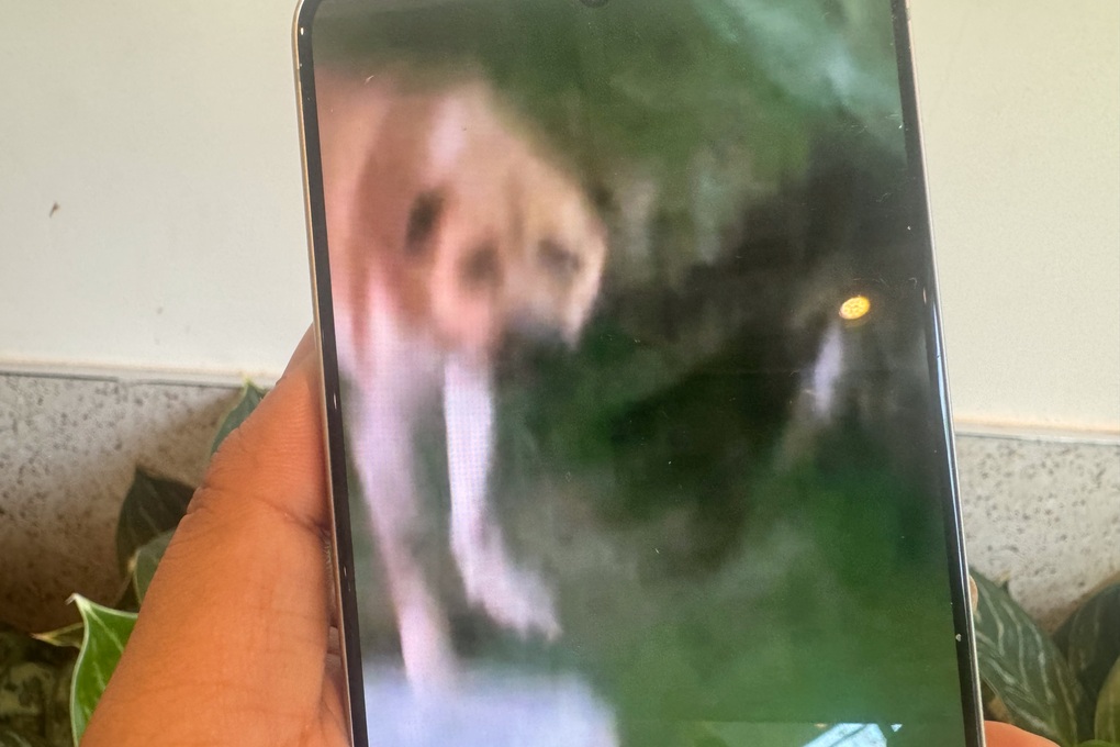 Bé gái bất ngờ bị chó tấn công vào vùng mặt ở TPHCM - 1 Bé gái bất ngờ bị chó tấn công vào vùng mặt ở TPHCM - 1