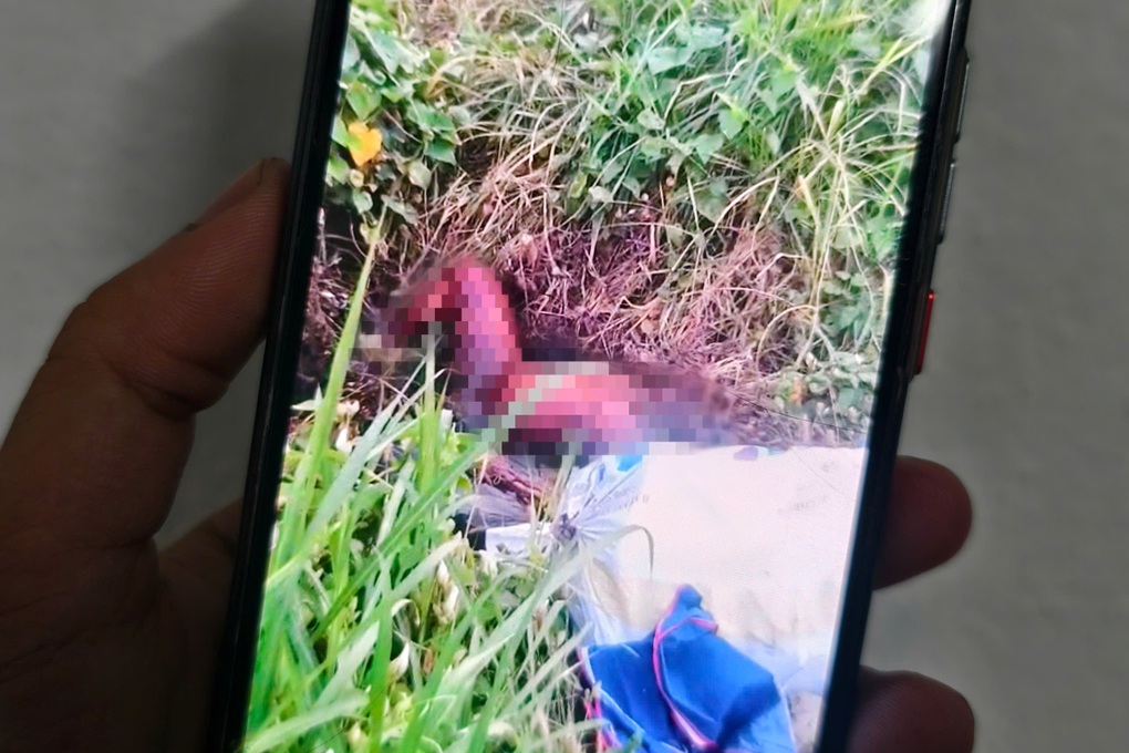 Một người tử vong trong tình trạng lõa thể ở TPHCM - 1