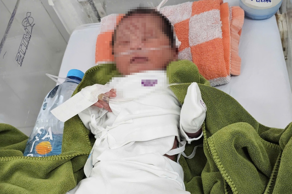 Bé gái bị vùi ở vườn cao su được đặt tên Thiện An, sắp có gia đình mới - 2