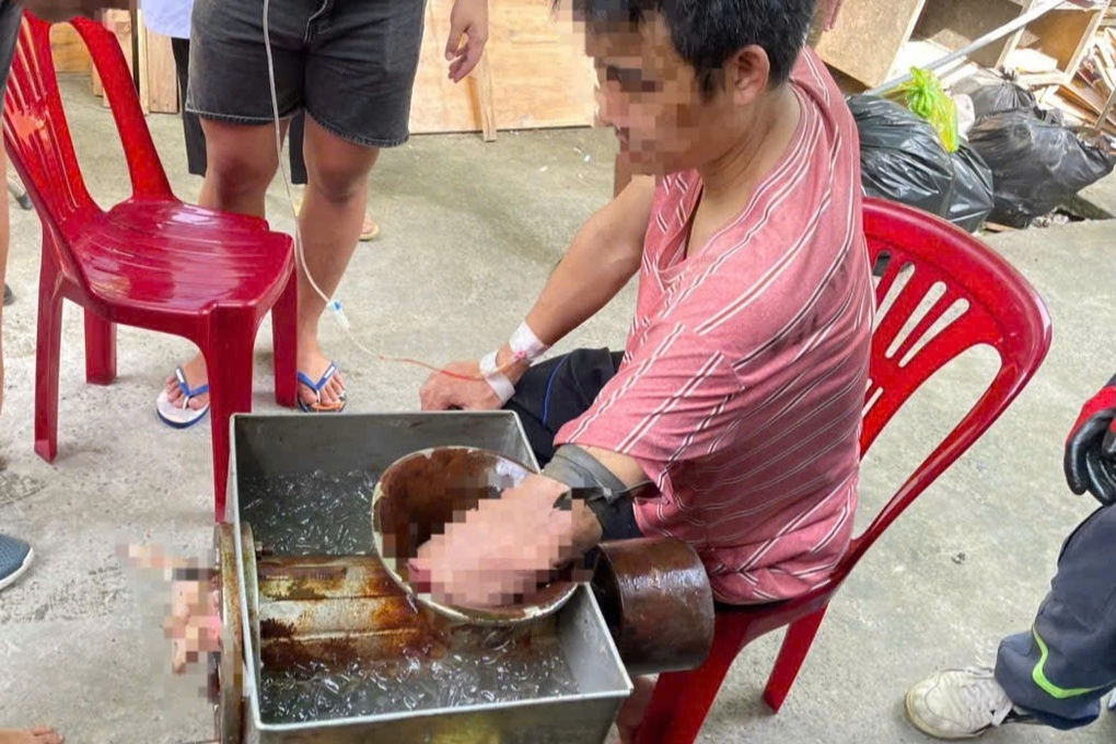 Người đàn ông bị cuốn cánh tay vào máy xay thịt ở TPHCM - 1