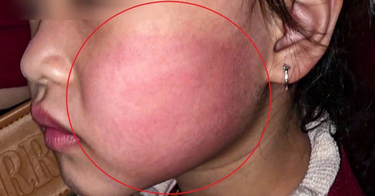 Xôn xao clip bé gái 4 tuổi bị người lạ tát khi đứng nhảy ngoài đường