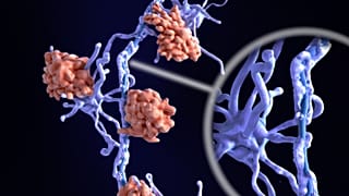Neuron affected by multiple sclerosis