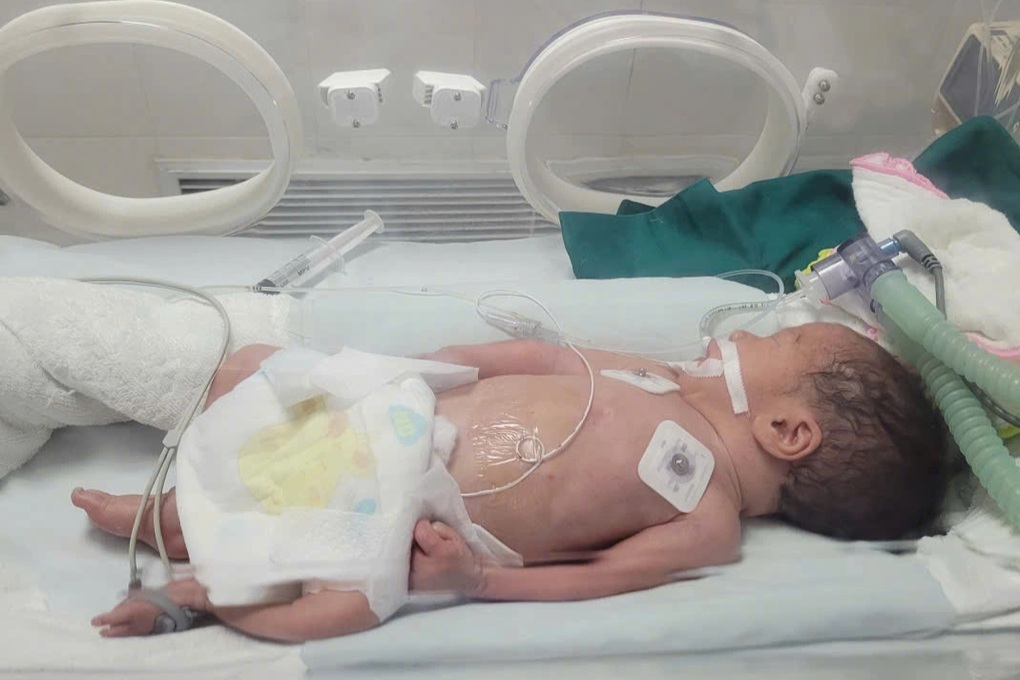 Phát hiện trẻ sơ sinh bị bỏ rơi, người dính đầy bùn đất - 1