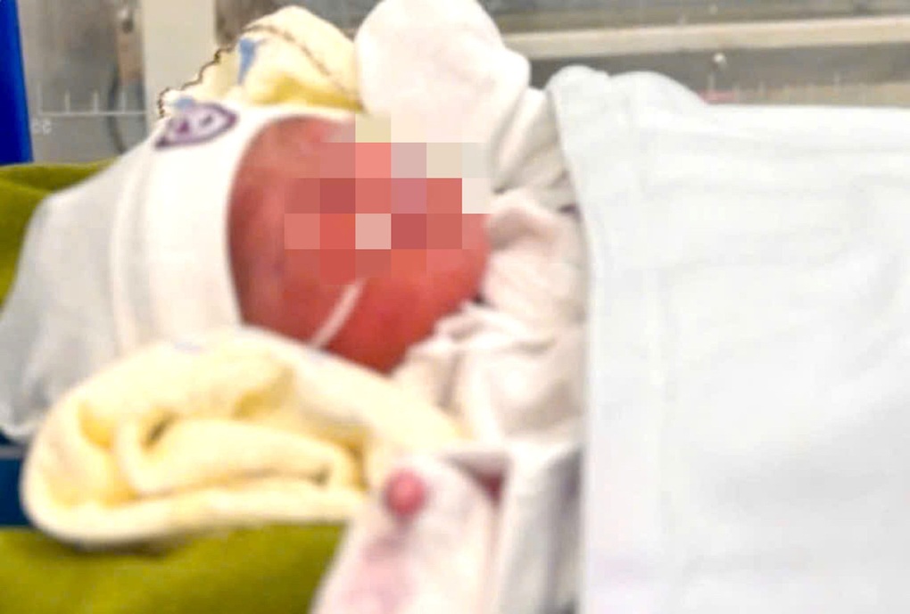 Trích xuất camera tìm người bỏ rơi bé gái ở cầu treo - 1