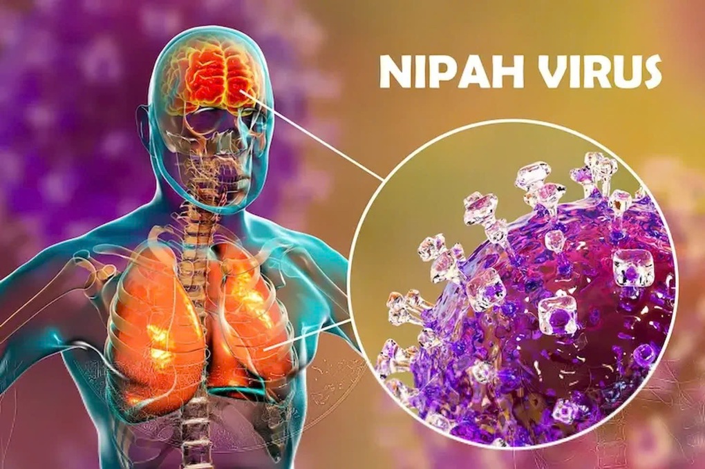 Bộ Ngoại giao thông tin về tình hình virus Nipah tại Việt Nam - 1
