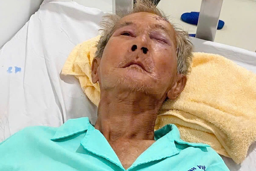 Tìm thân nhân người đàn ông đang điều trị tại bệnh viện ở Tây Ninh - 1